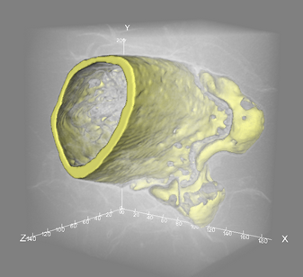 Bone sample displayed in both volume and isosurface rendering modes
